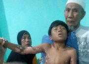 Disengat Listrik, Anak Umur 8 tahun Asal Lombok Terpental 1 Meter dan Dilarikan Ke Rumah Sakit